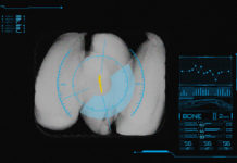 ‘Advanced’ X-ray tech launched for ‘hard to find’ contaminants
