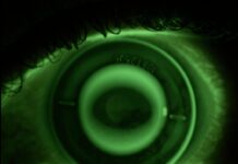 Laser coder vision pays off for contact lens producer